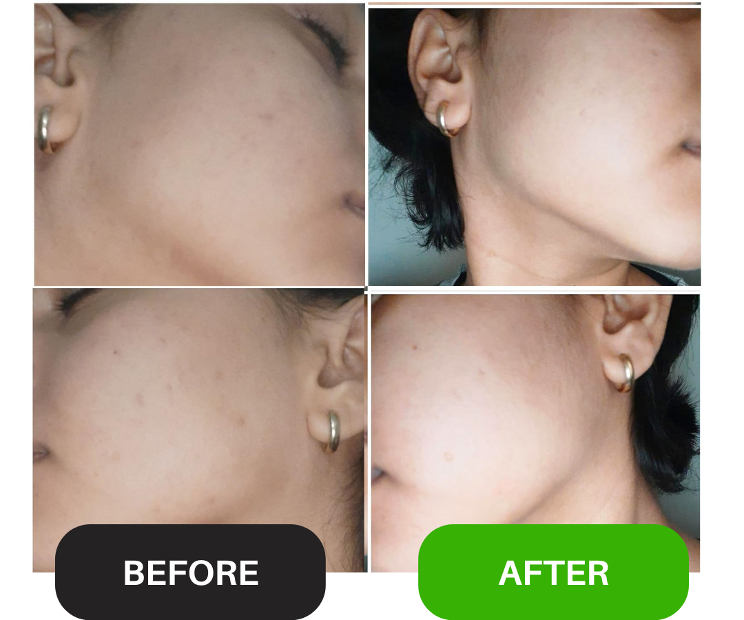 Whitening Serum: Perfect Skin Booster