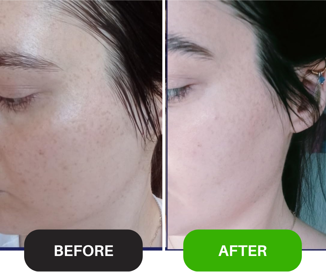 Whitening Serum: Perfect Skin Booster
