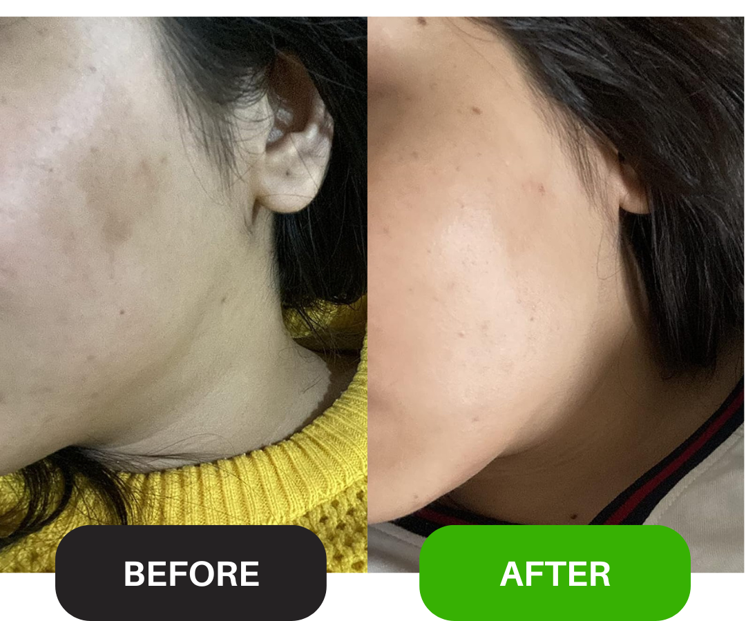 Whitening Serum: Perfect Skin Booster