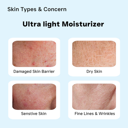 Anti Ageing: Ultra Light Moisturizer